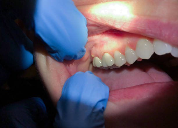 Best Emergency Dental Care for Sports Injuries in Reese, MI