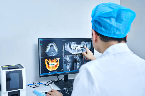 Best Emergency Wisdom Tooth Extraction in Reese, MI